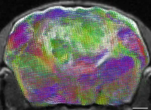 mice with half-human brains